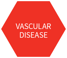 Vascular Disease Experience
